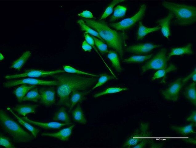 Anti-WTIP antibody produced in rabbit