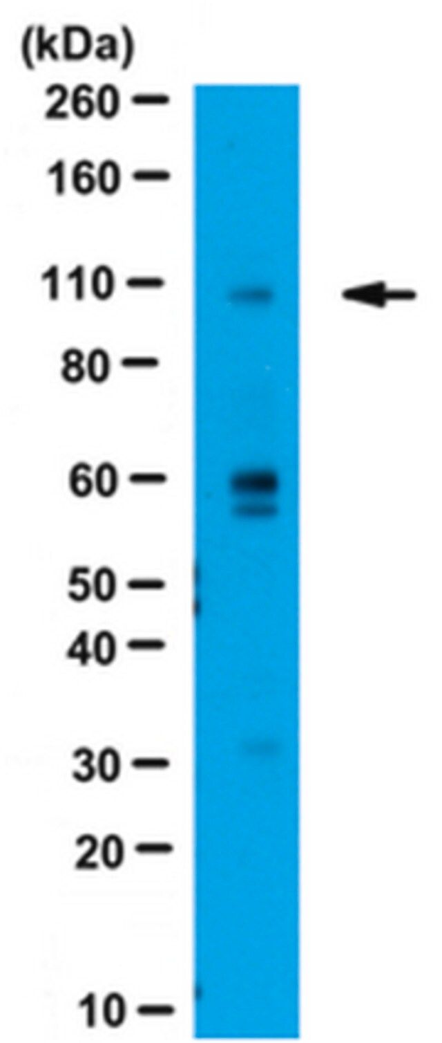 Anti-WWP2 Antibody