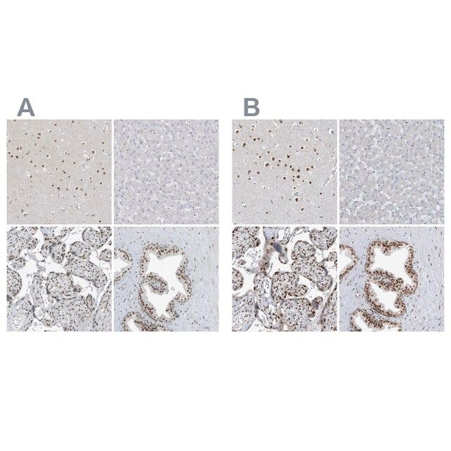 Anti-WRNIP1 antibody produced in rabbit