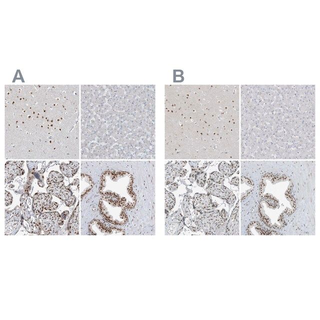 Anti-WRNIP1 antibody produced in rabbit