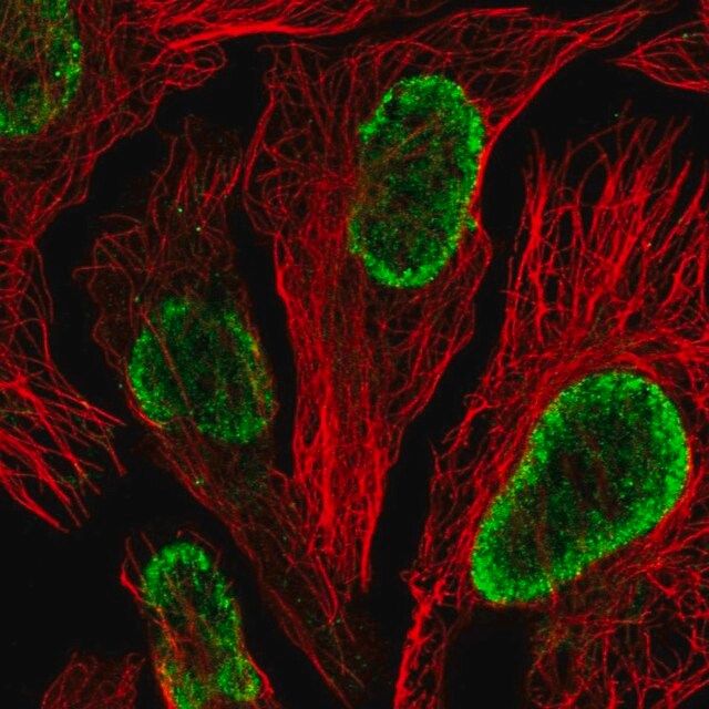 Anti-WSCD2 antibody produced in rabbit