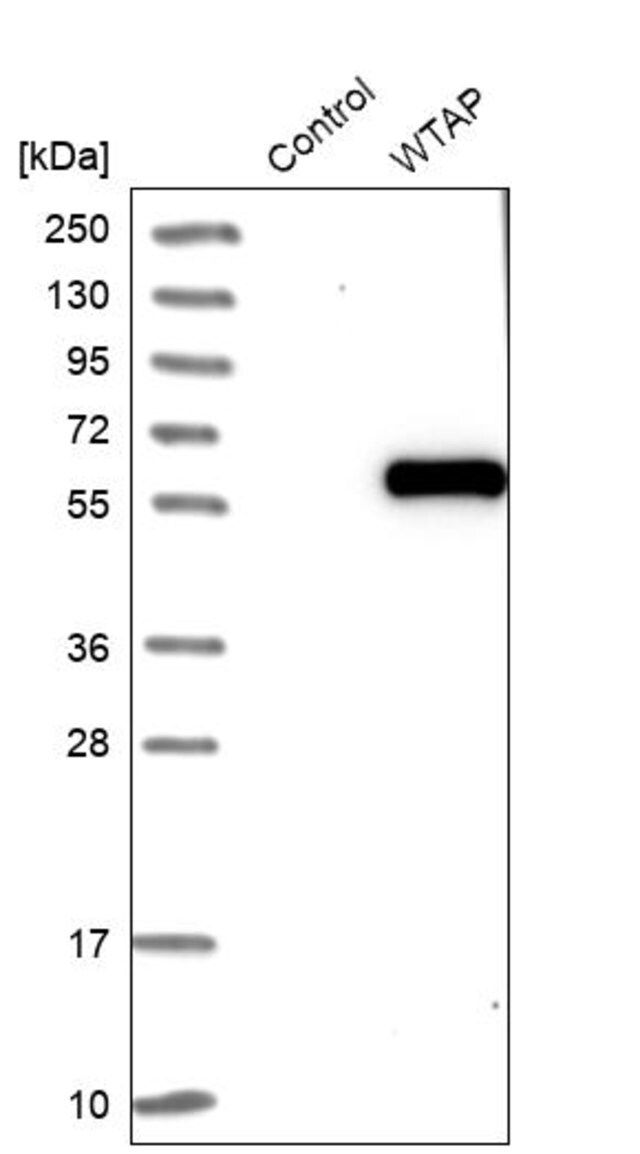 Anti-WTAP antibody produced in rabbit