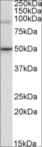 Anti-WRNIP1 (C-terminal) antibody produced in goat