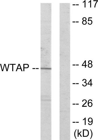 Anti-WTAP antibody produced in rabbit