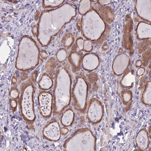 Anti-WWOX antibody produced in rabbit