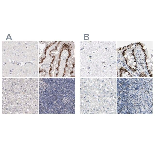 Anti-ZBTB7B antibody produced in rabbit