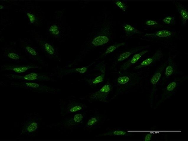 Anti-ZCCHC9 antibody produced in mouse