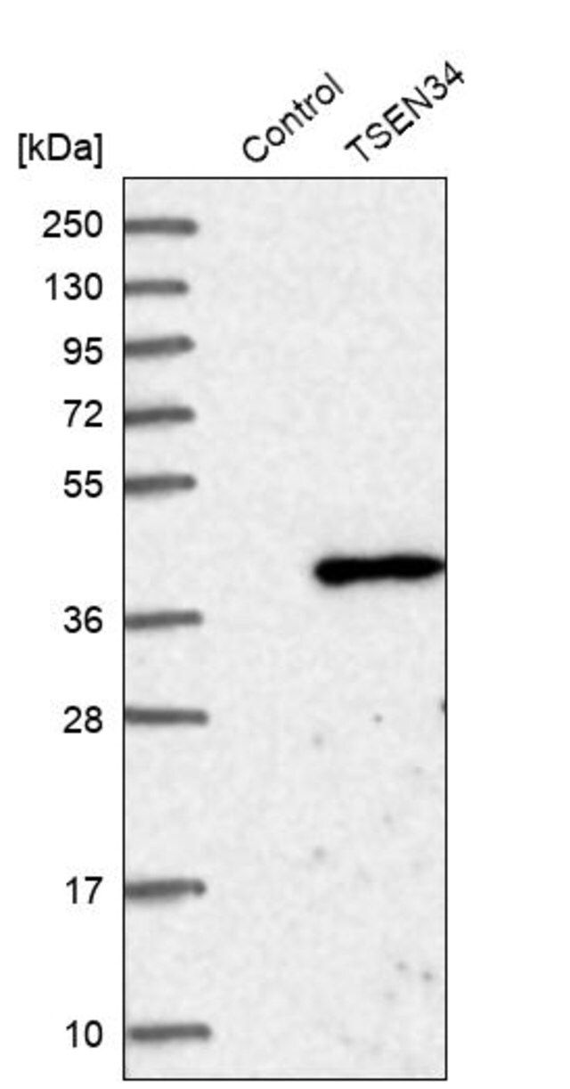 Anti-TSEN34 antibody produced in rabbit