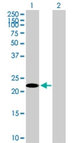 Anti-TSC22D3 antibody produced in mouse