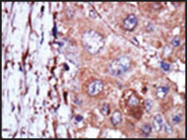 Anti-TRRAP (C-term) antibody produced in rabbit