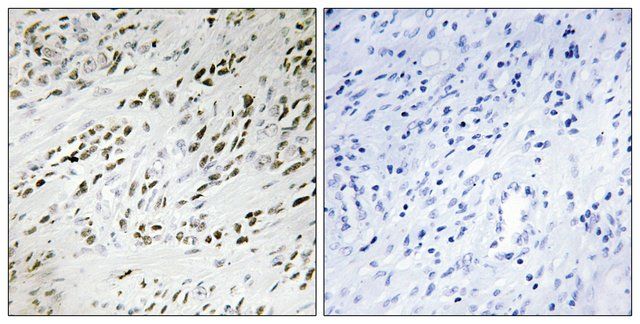 Anti-TSH2 antibody produced in rabbit