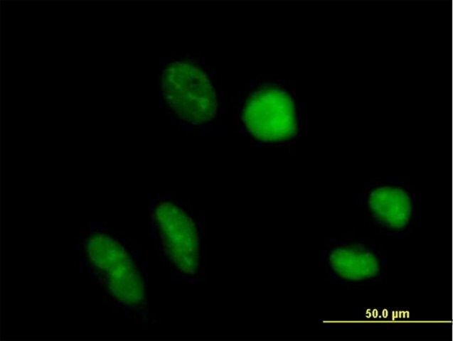 Anti-TRUB1 antibody produced in mouse