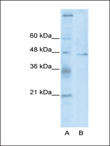 Anti-TSG101 antibody produced in rabbit