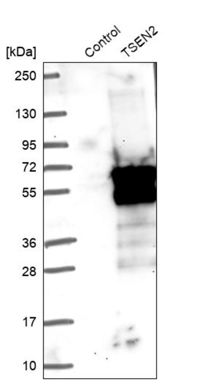 Anti-TSEN2 antibody produced in rabbit