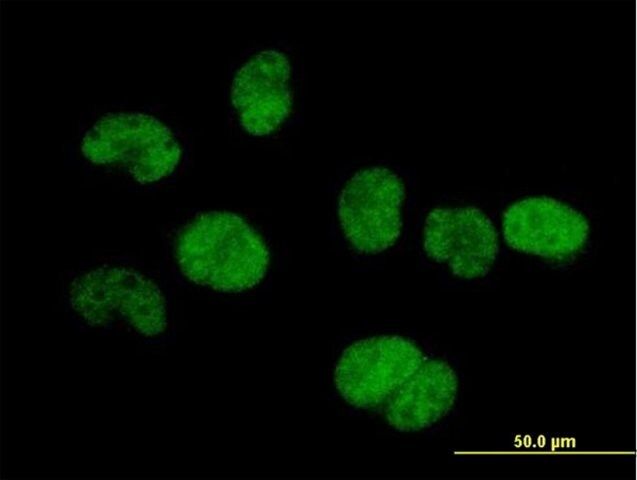 Anti-TSEN34 antibody produced in mouse