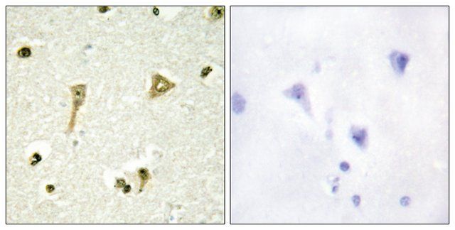 Anti-TSC22D1 antibody produced in rabbit