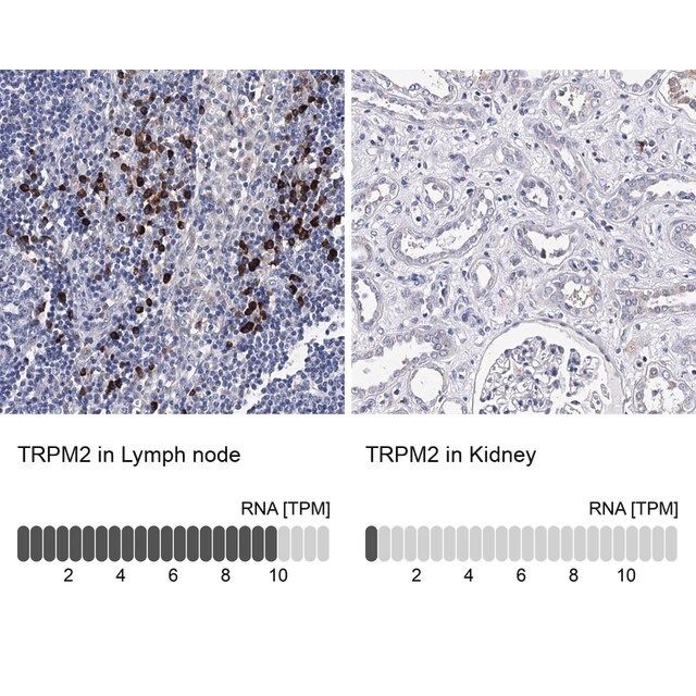 Anti-TRPM2 antibody produced in rabbit