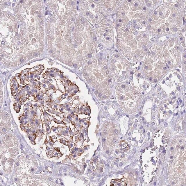 Anti-TSGA13 antibody produced in rabbit