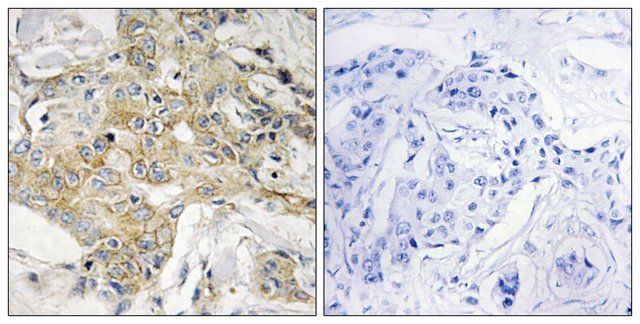 Anti-T4S1 antibody produced in rabbit