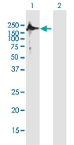 Anti-TSHZ2 antibody produced in mouse