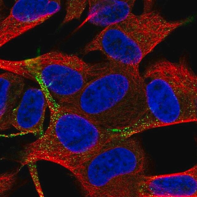 Anti-TSPAN11 antibody produced in rabbit