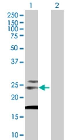 Anti-TSPAN31 antibody produced in mouse