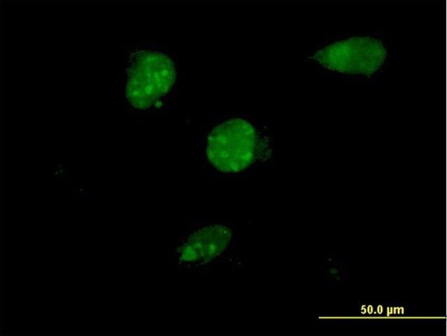 ANTI-TSC22D4 antibody produced in mouse