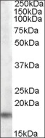 Anti-Tspo (C-terminal) antibody produced in goat