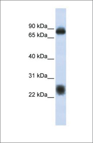 Anti-TSPAN8 antibody produced in rabbit