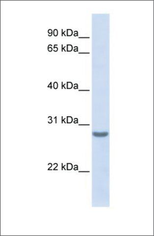 Anti-TSPAN6 antibody produced in rabbit