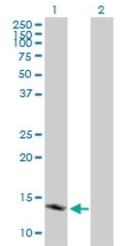 Anti-TSPO antibody produced in mouse