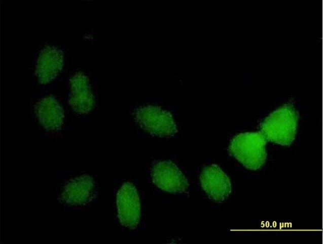 Anti-TSPYL4 antibody produced in mouse