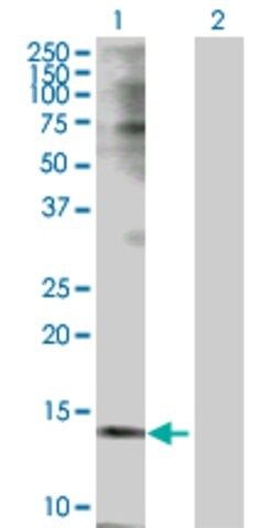 Anti-TSPO antibody produced in rabbit