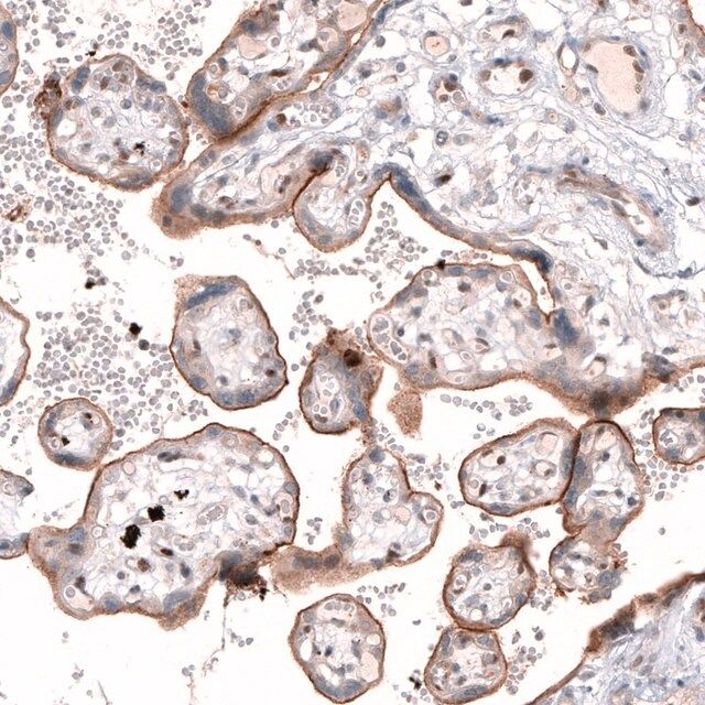 Anti-TSPAN13 antibody produced in rabbit