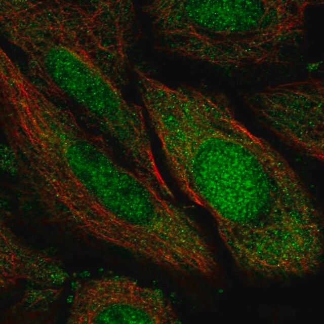 Anti-TSNAXIP1 antibody produced in rabbit