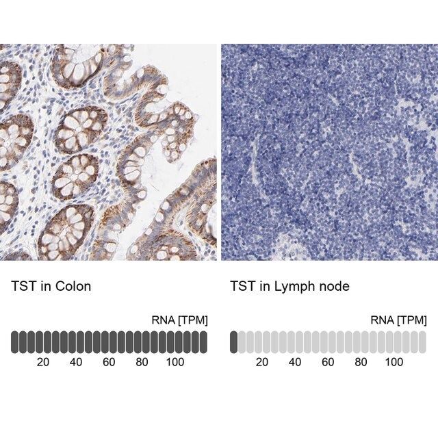 Anti-TST antibody produced in rabbit