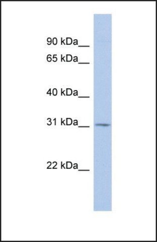 Anti-TSPAN12 antibody produced in rabbit