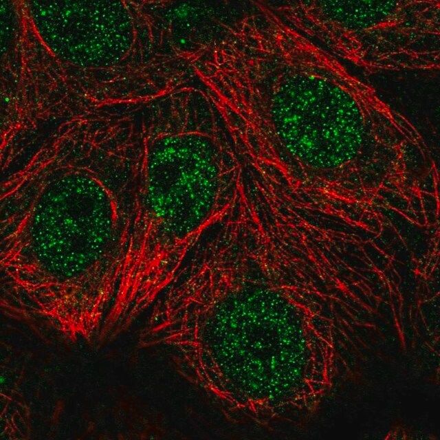 Anti-TSPAN17 antibody produced in rabbit