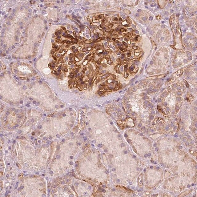 Anti-TSPO2 antibody produced in rabbit