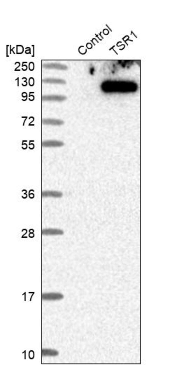 Anti-TSR1 antibody produced in rabbit