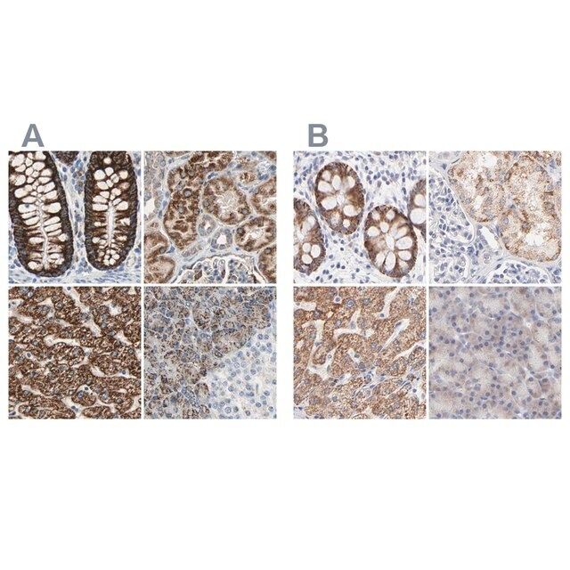 Anti-TST antibody produced in rabbit