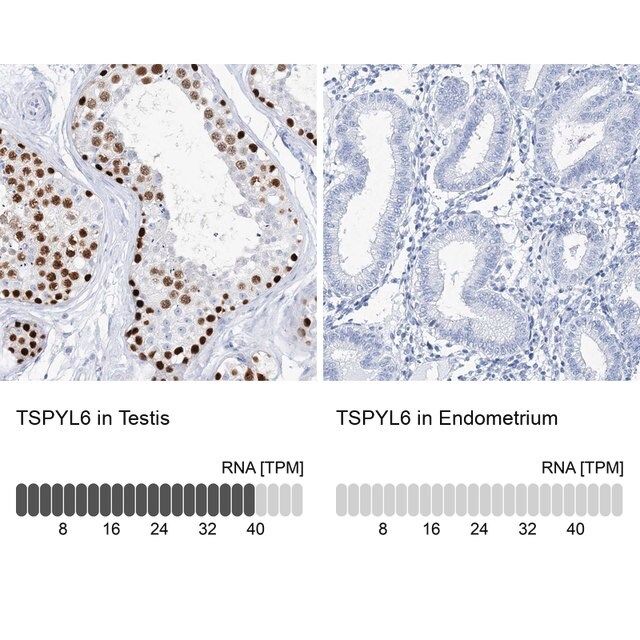 Anti-TSPYL6 antibody produced in rabbit