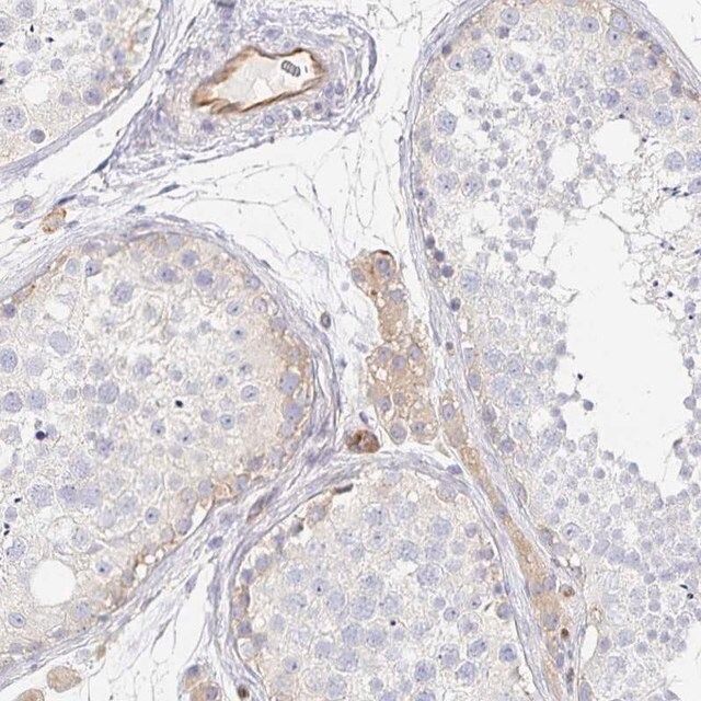 Anti-TSPAN19 antibody produced in rabbit