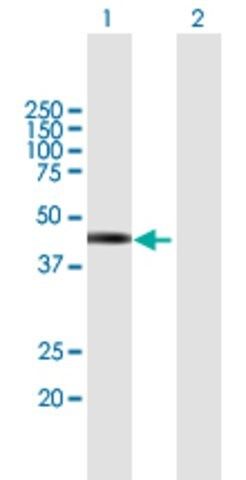 Anti-TSPY2 antibody produced in mouse