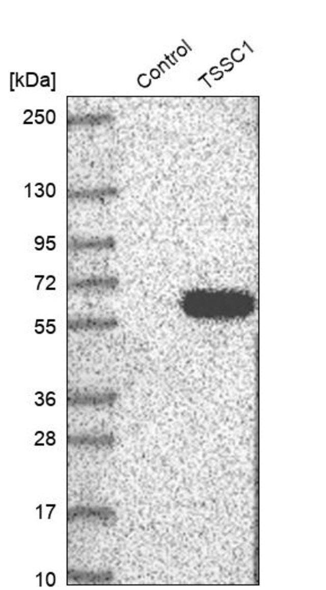 Anti-TSSC1 antibody produced in rabbit