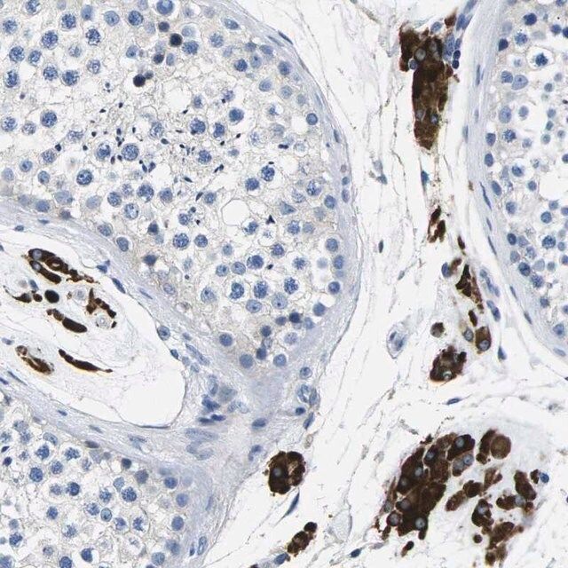 Anti-TSPAN2 antibody produced in rabbit