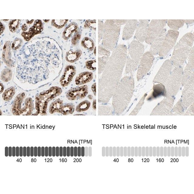 Anti-TSPAN1 antibody produced in rabbit