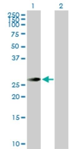 Anti-TSSK3 antibody produced in rabbit