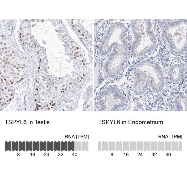 Anti-TSPYL6 antibody produced in rabbit