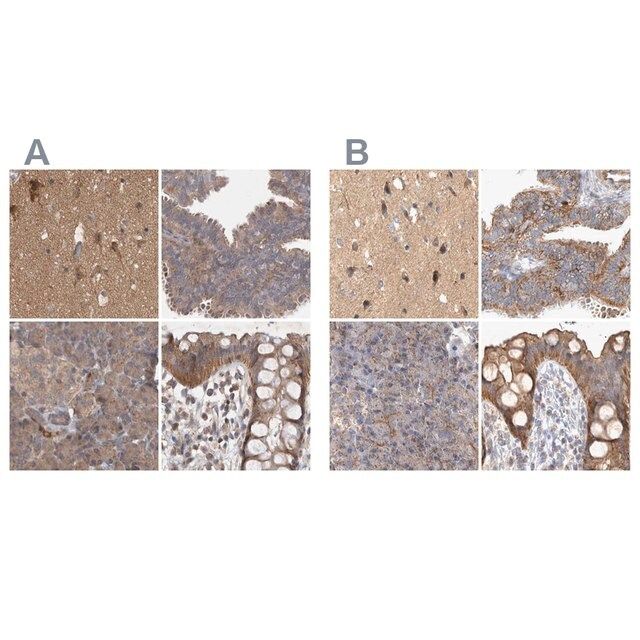 Anti-TSPOAP1 antibody produced in rabbit